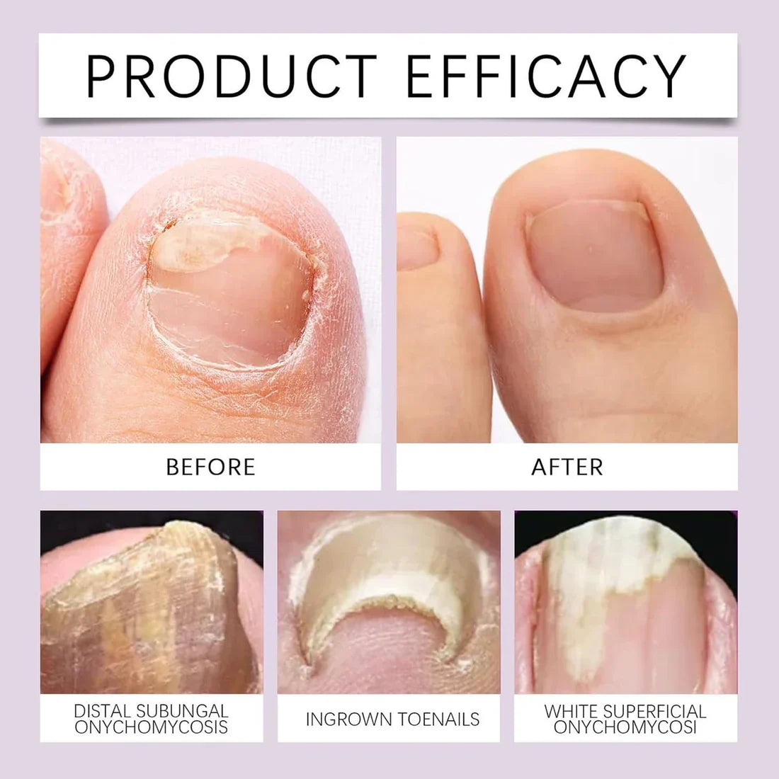 BeeVenom Nail Serum - Natural Repair & Strength for Vibrant Nails