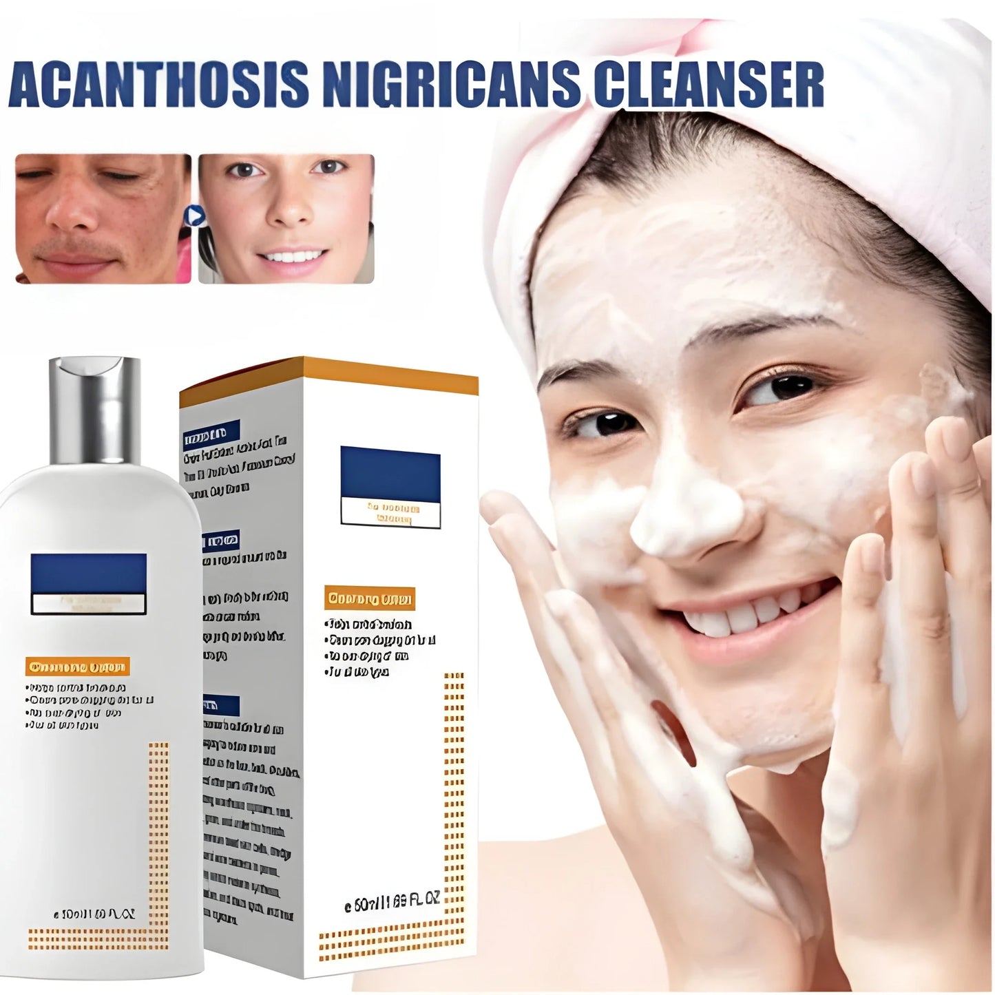 Acne Spot Treatment Lotion