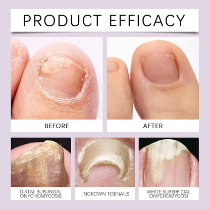 BeeVenom Nail Serum - Natural Repair & Strength for Vibrant Nails
