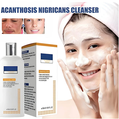 Acne Spot Treatment Lotion